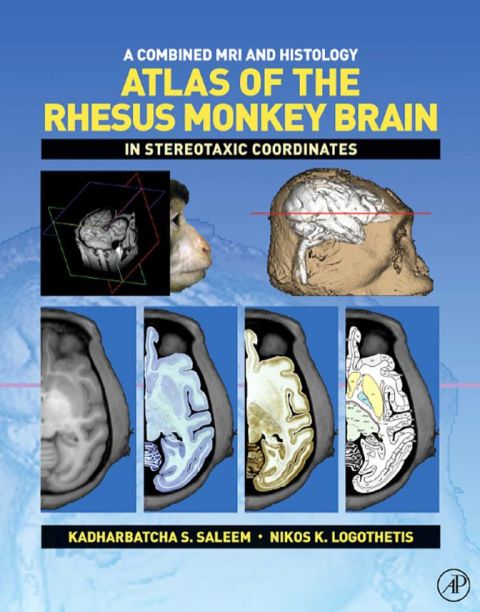 Cover image for book A Combined MRI and Histology Atlas of the Rhesus Monkey Brain in Stereotaxic Coordinates