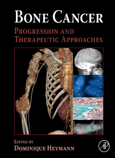 Cover image for book Bone Cancer: Progression and Therapeutic Approaches