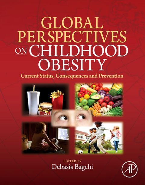 Cover image for book Global Perspectives on Childhood Obesity: Current Status, Consequences and Prevention