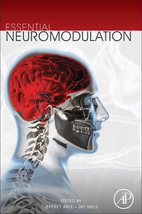 Cover image for book Essential Neuromodulation