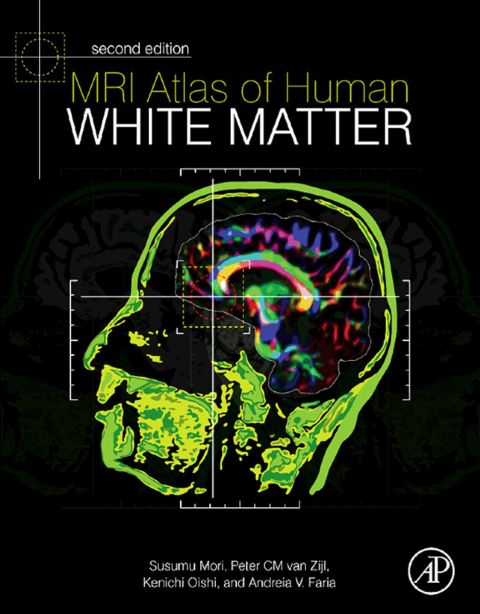 Cover image for book MRI Atlas of Human White Matter