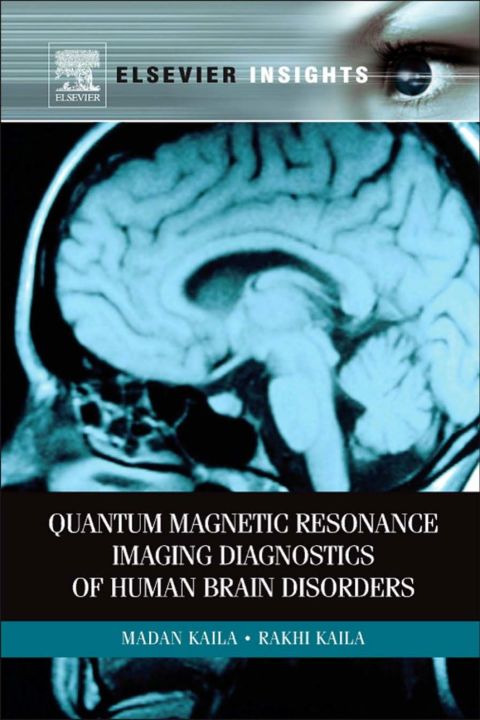 Cover image for book Quantum Magnetic Resonance Imaging Diagnostics of Human Brain Disorders