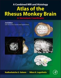 Titelbild: A Combined MRI and Histology Atlas of the Rhesus Monkey Brain in Stereotaxic Coordinates 2nd edition 9780123850874