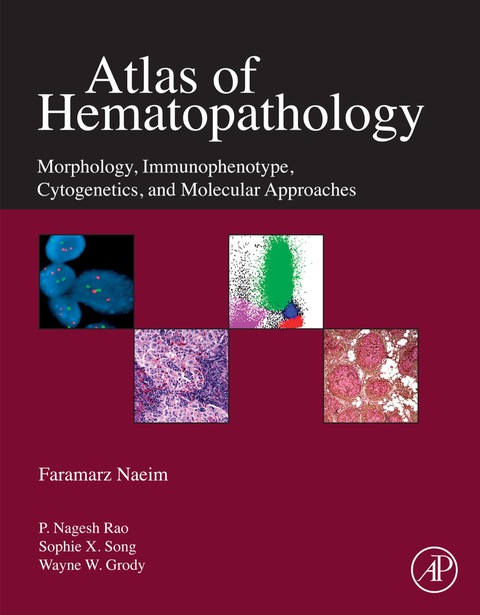 Cover image for book Atlas of Hematopathology: Morphology, Immunophenotype, Cytogenetics, and Molecular Approaches