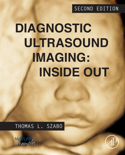 Cover image for book Diagnostic Ultrasound Imaging: Inside Out