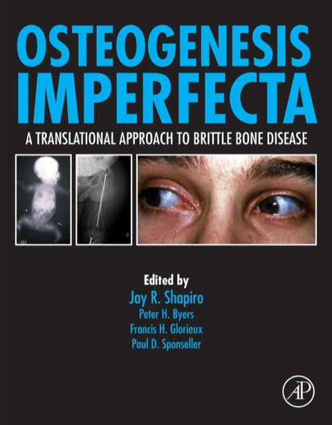 Cover image for book Osteogenesis Imperfecta: A Translational Approach to Brittle Bone Disease