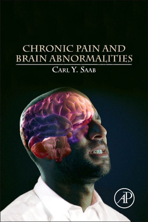 Cover image for book Chronic Pain and Brain Abnormalities