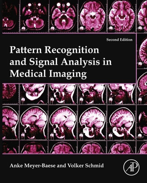 Cover image for book Pattern Recognition and Signal Analysis in Medical Imaging
