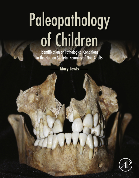 Cover image for book Paleopathology of Children