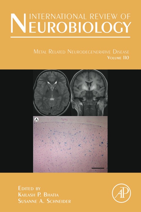 Cover image for book Metal Related Neurodegenerative Disease