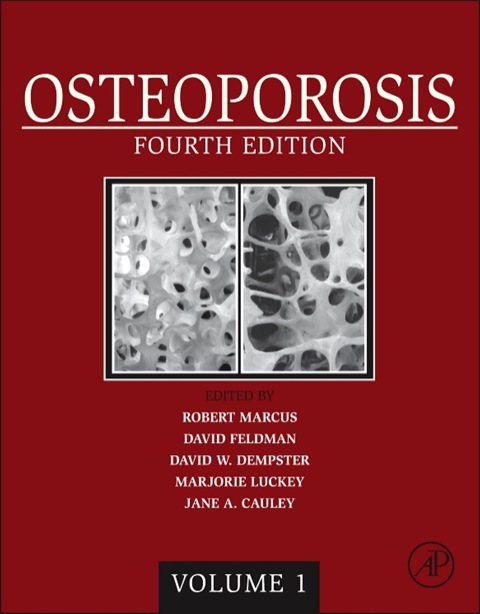 Cover image for book Osteoporosis: Two-Volume Set