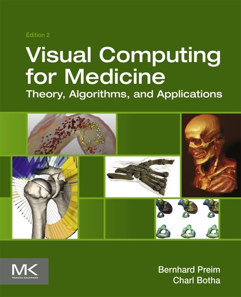 Cover image for book Visual Computing for Medicine: Theory, Algorithms, and Applications