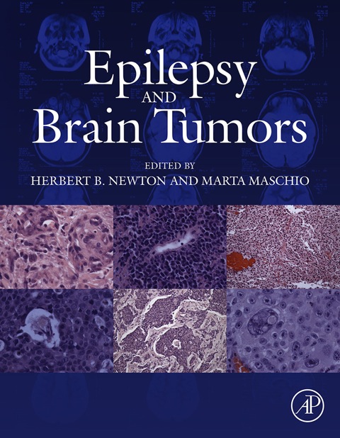 Cover image for book Epilepsy and Brain Tumors