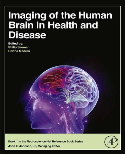 Cover image for book Imaging of the Human Brain in Health and Disease