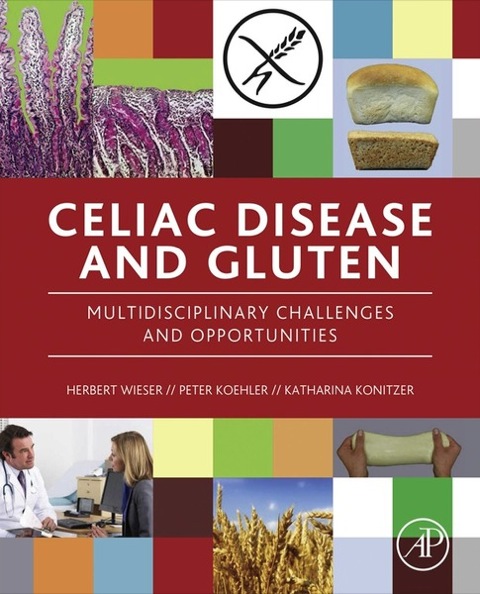 Cover image for book Celiac Disease and Gluten: Multidisciplinary Challenges and Opportunities