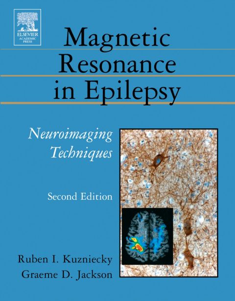[1825 days] Magnetic Resonance in Epilepsy: Neuroimaging Techniques