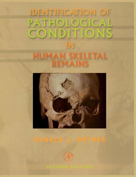 [150 days] Identification of Pathological Conditions in Human Skeletal Remains