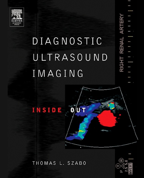 Cover image for book Diagnostic Ultrasound Imaging: Inside Out
