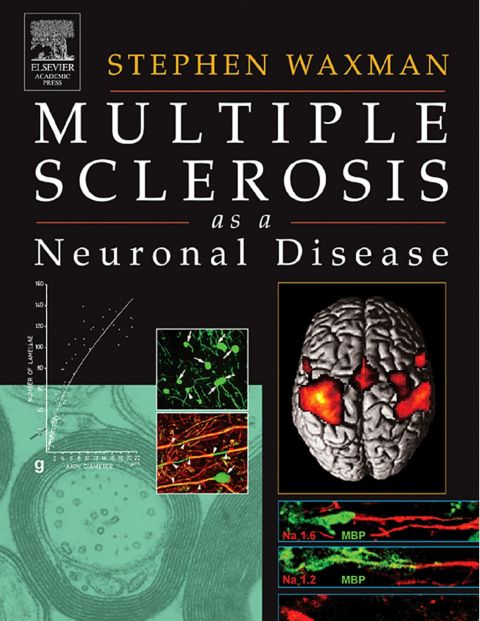 [1825 days] Multiple Sclerosis As A Neuronal Disease