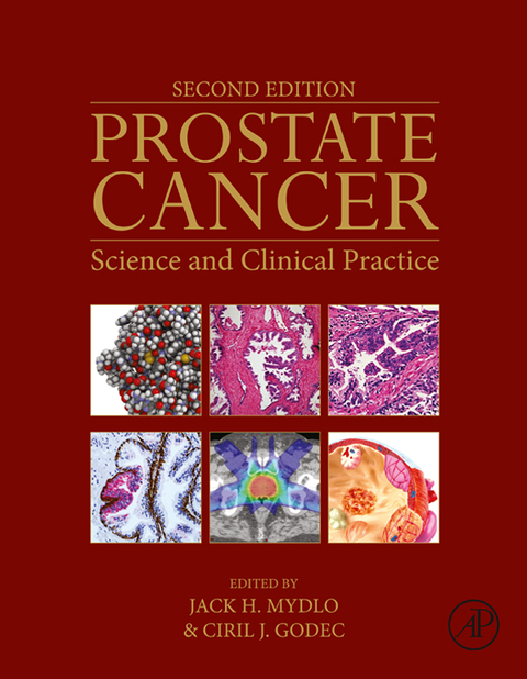 Cover image for book Prostate Cancer