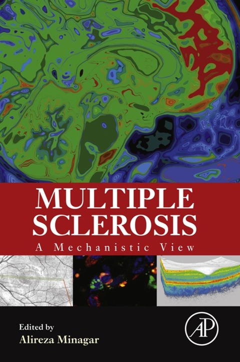 Cover image for book Multiple Sclerosis: A Mechanistic View