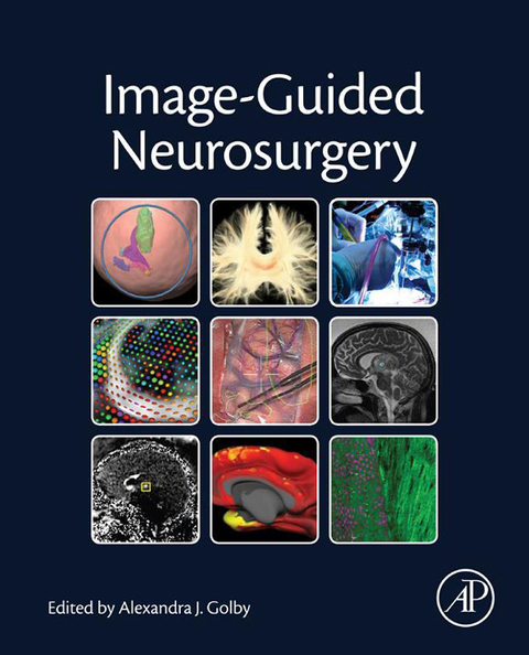 Cover image for book Image-Guided Neurosurgery