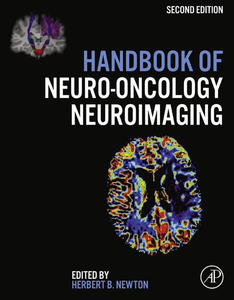 Cover image for book Handbook of Neuro-Oncology Neuroimaging