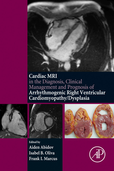 Cover image for book The Cardiac MRI in Diagnosis, Clinical Management, and Prognosis of Arrhythmogenic Right Ventricular Cardiomyopathy/Dysplasia