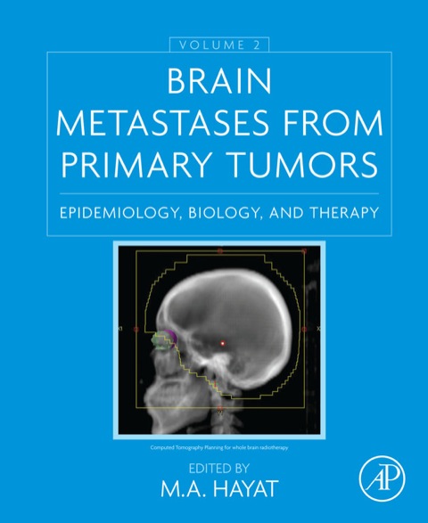 Cover image for book Brain Metastases from Primary Tumors, Volume 2: Epidemiology, Biology, and Therapy