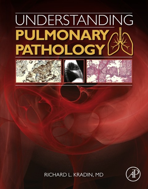 Cover image for book Understanding Pulmonary Pathology