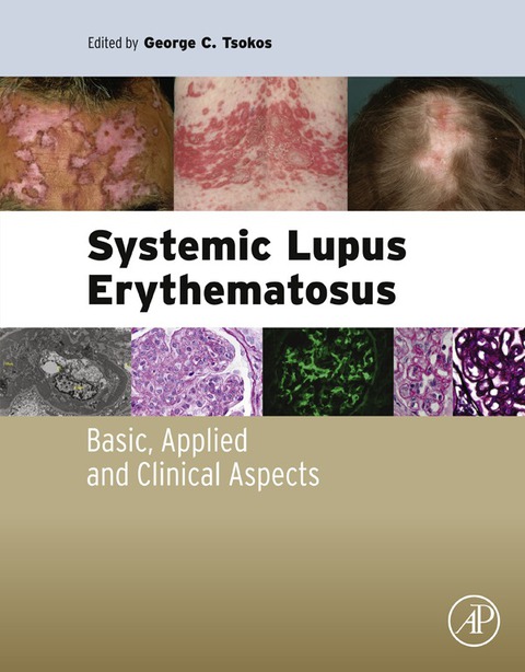 Cover image for book Systemic Lupus Erythematosus: Basic, Applied and Clinical Aspects