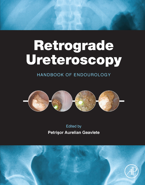 Cover image for book Retrograde Ureteroscopy: Handbook of Endourology