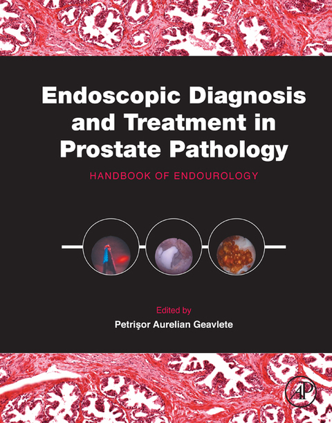 Cover image for book Endoscopic Diagnosis and Treatment in Prostate Pathology: Handbook of Endourology
