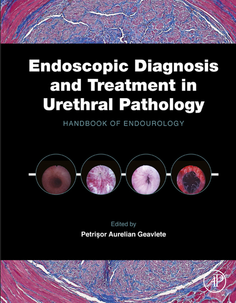 Cover image for book Endoscopic Diagnosis and Treatment in Urethral Pathology: Handbook of Endourology