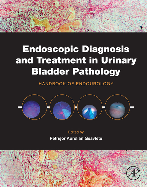 Cover image for book Endoscopic Diagnosis and Treatment in Urinary Bladder Pathology: Handbook of Endourology