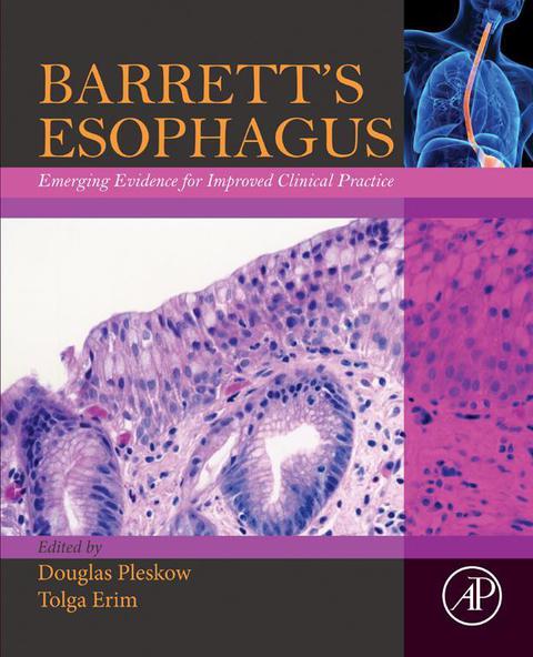 Cover image for book Barrett’s Esophagus