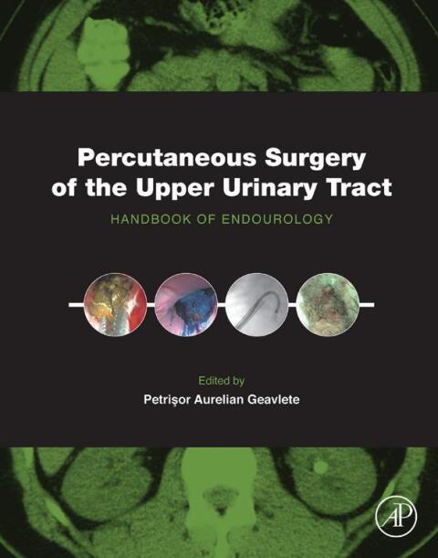 Cover image for book Percutaneous Surgery of the Upper Urinary Tract