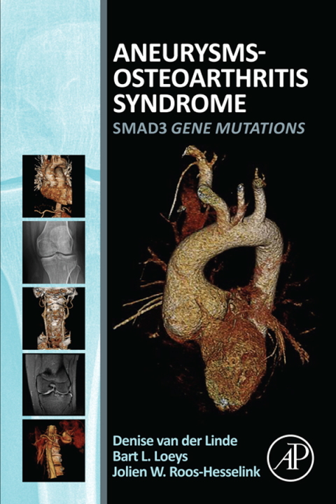 Cover image for book Aneurysms-Osteoarthritis Syndrome