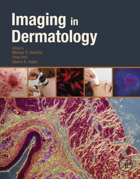 Cover image for book Imaging in Dermatology