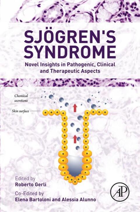Cover image for book Sjogren's Syndrome