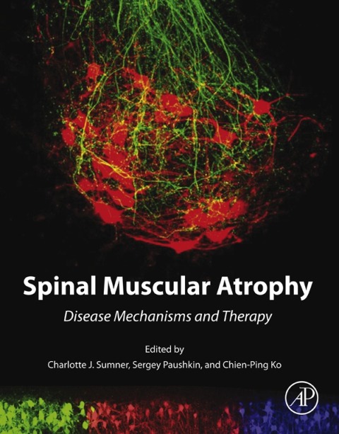 Cover image for book Spinal Muscular Atrophy
