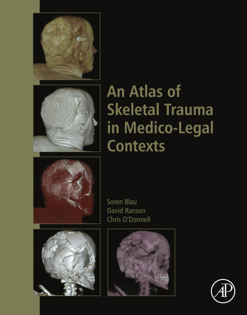 Cover image for book An Atlas of Skeletal Trauma in Medico-Legal Contexts