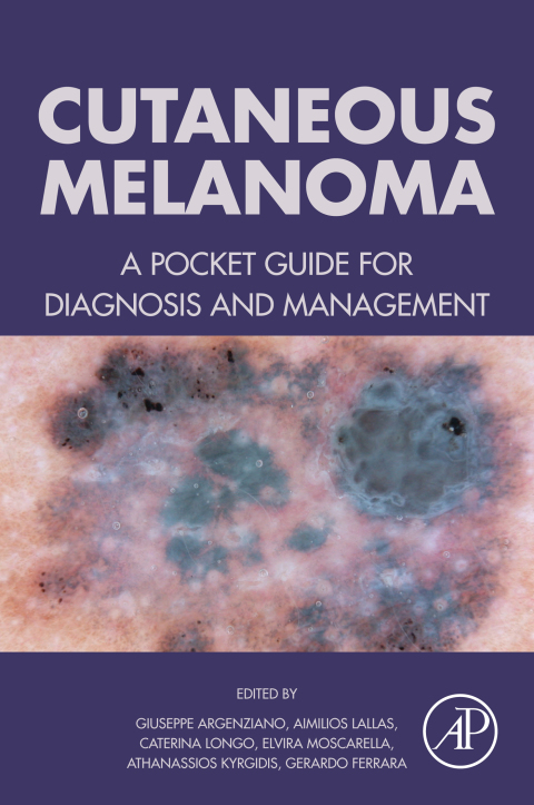 Cover image for book Cutaneous Melanoma