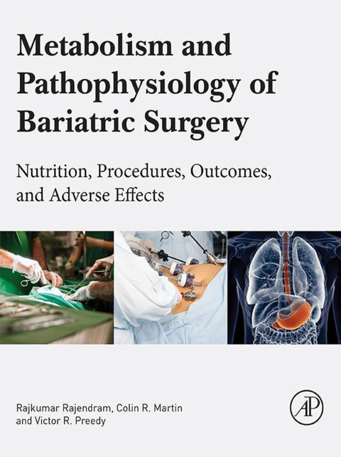 Cover image for book Metabolism and Pathophysiology of Bariatric Surgery