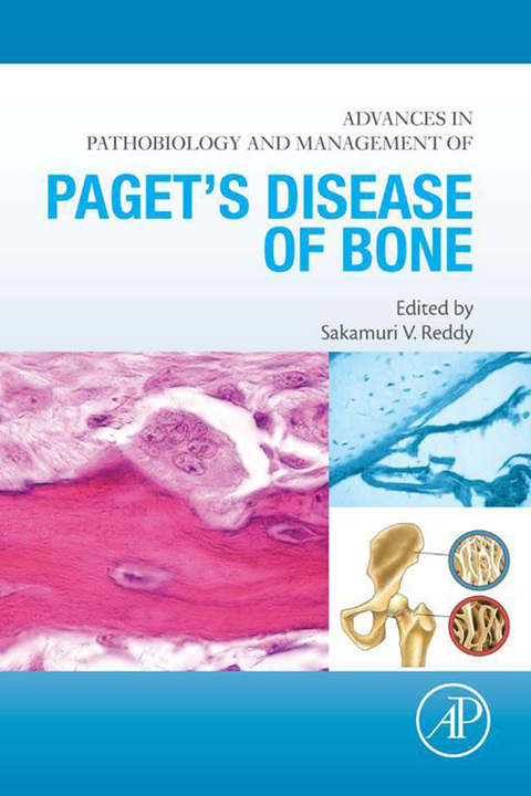 Cover image for book Advances in Pathobiology and Management of Paget’s Disease of Bone