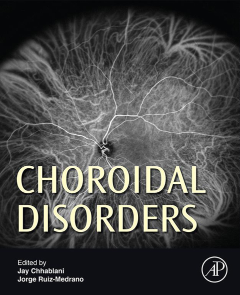 Cover image for book Choroidal Disorders