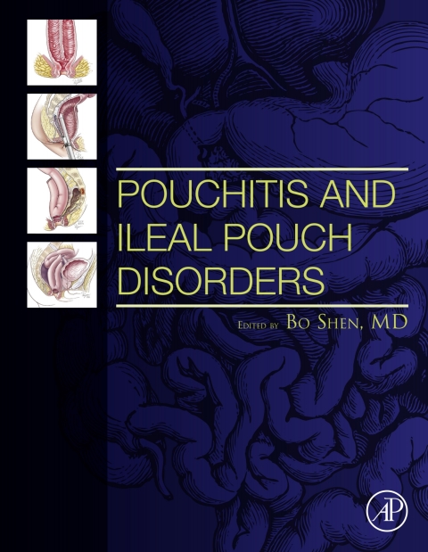 Cover image for book Pouchitis and Ileal Pouch Disorders
