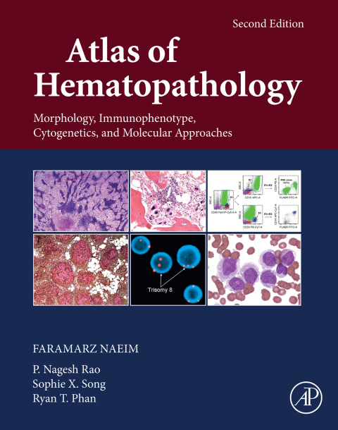 Cover image for book SPEC – Atlas of Hematopathology: Morphology, Immunophenotype, Cytogenetics, and Molecular Approaches, 12-Month Access, eBook