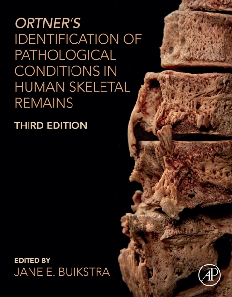 Ident.Of Patholog.Cond.In Human Skel...