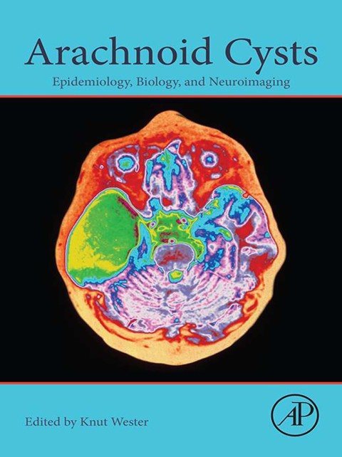 Cover image for book Arachnoid Cysts